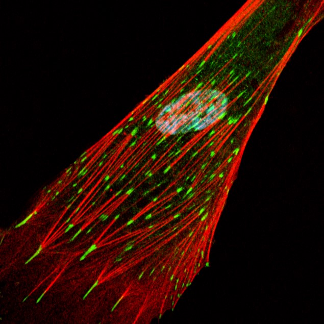 Human Fibroblast