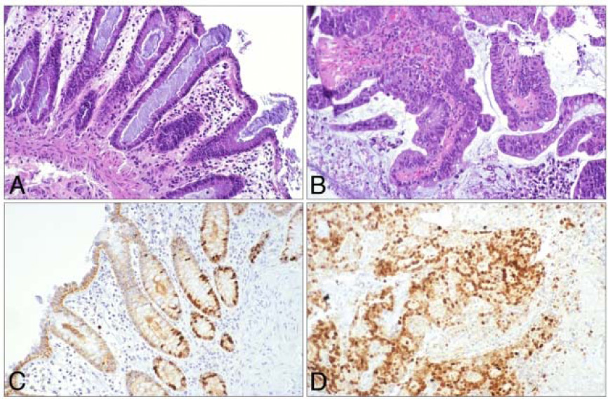 Tumor Biology