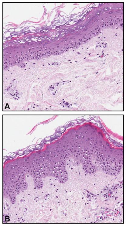 Skin Organ Culture